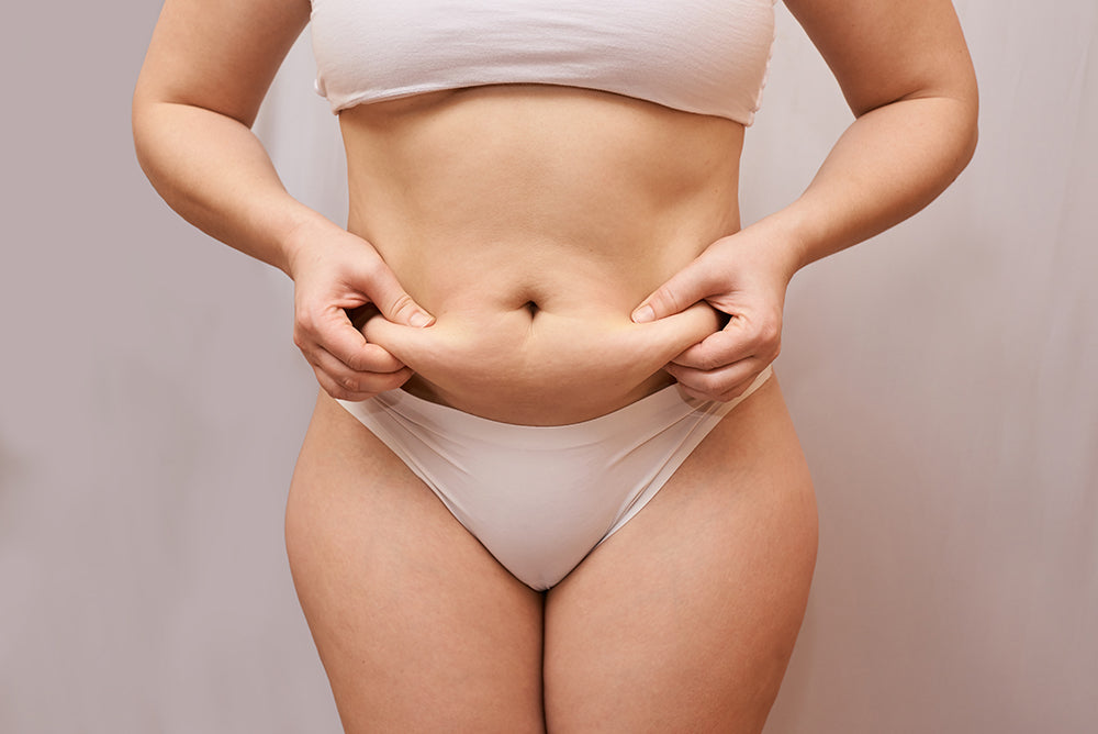 Researchers Finally Find a Cause for Cellulite Dimples!