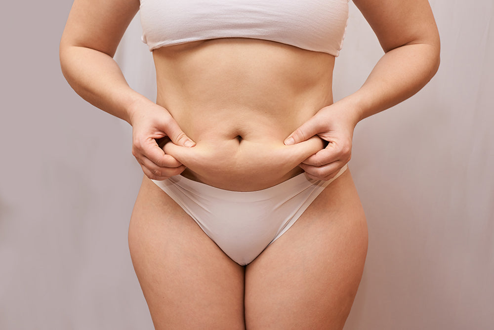 Cellulite on the Stomach: Causes and How to Get Rid of It